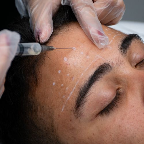 Estética facial avançada