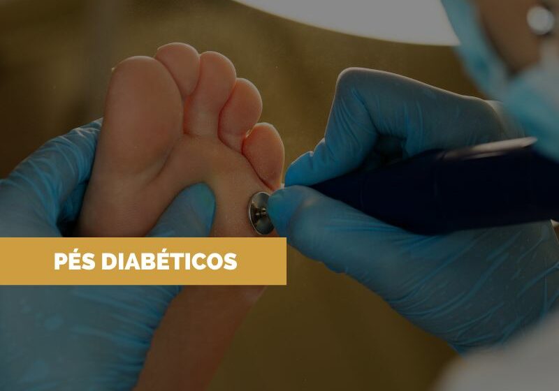 Tratamento-pés-diabeticos Tratamento para Pés Diabéticos